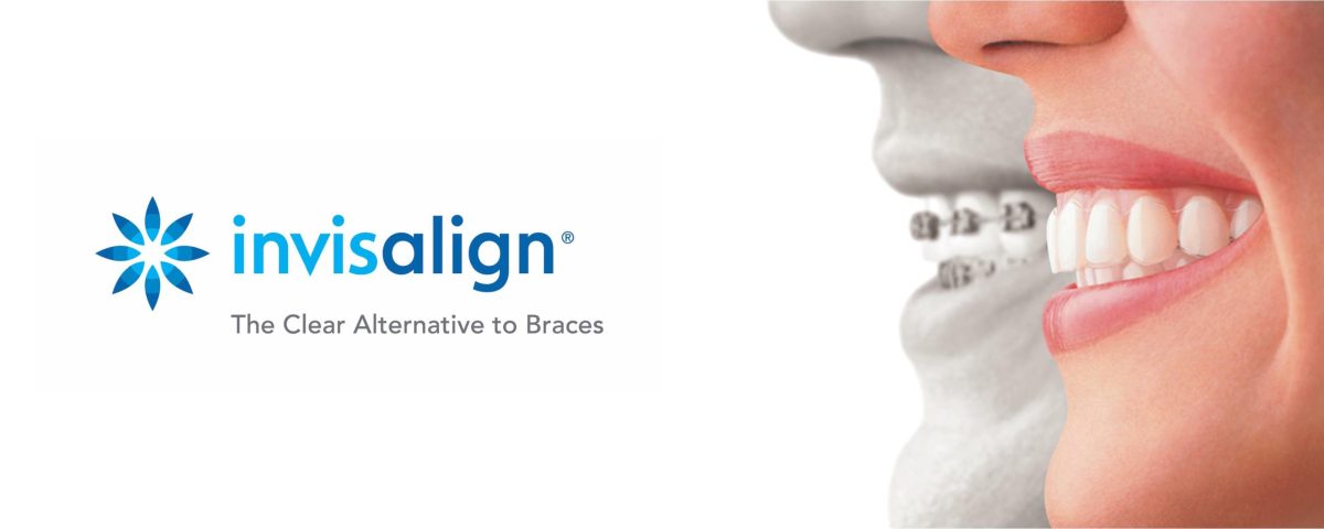 Is Invisalign Worth It for You?