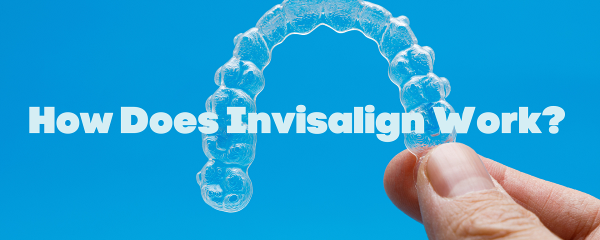 How Does Invisalign Work? It's so Magical!